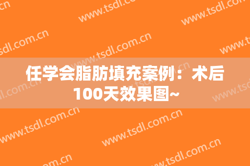 任学会脂肪填充案例：术后100天效果图~