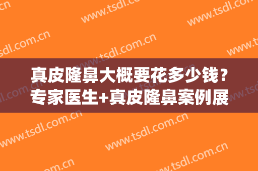 真皮隆鼻大概要花多少钱？专家医生+真皮隆鼻案例展示(正规隆鼻多少钱)