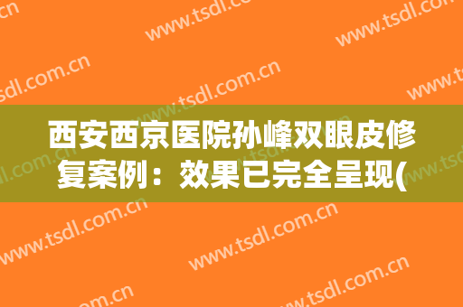 西安西京医院孙峰双眼皮修复案例：效果已完全呈现(西安双眼皮医生孙峰)