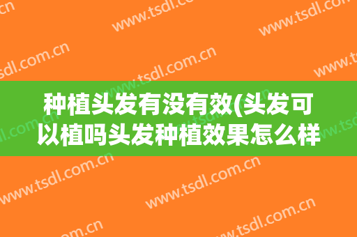 种植头发有没有效(头发可以植吗头发种植效果怎么样)