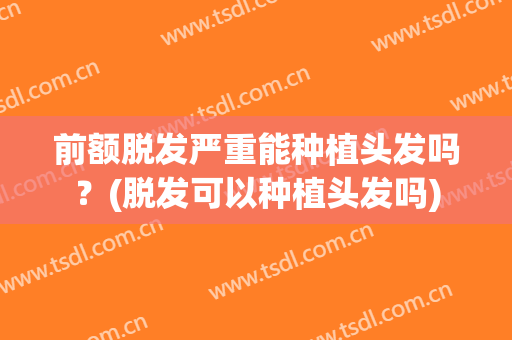 前额脱发严重能种植头发吗？(脱发可以种植头发吗)