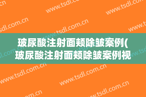 玻尿酸注射面颊除皱案例(玻尿酸注射面颊除皱案例视频)