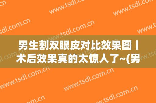 男生割双眼皮对比效果图丨术后效果真的太惊人了~(男孩子割双眼皮前后对比效果图)