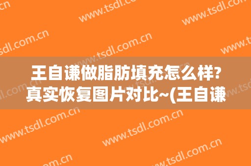 王自谦做脂肪填充怎么样?真实恢复图片对比~(王自谦面部吸脂)