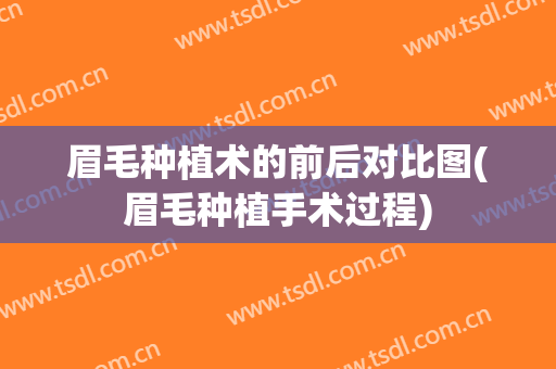 眉毛种植术的前后对比图(眉毛种植手术过程)