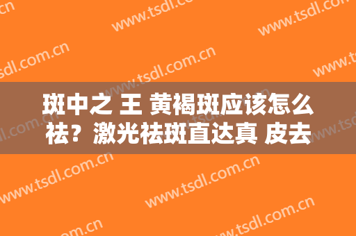 斑中之 王 黄褐斑应该怎么祛？激光祛斑直达真 皮去斑