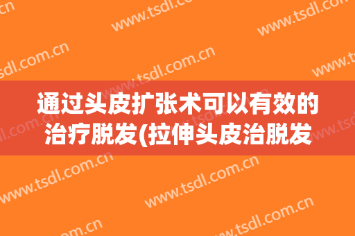 通过头皮扩张术可以有效的治疗脱发(拉伸头皮治脱发)