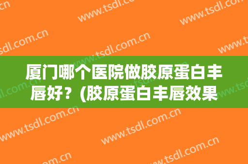 厦门哪个医院做胶原蛋白丰唇好？(胶原蛋白丰唇效果怎么样)