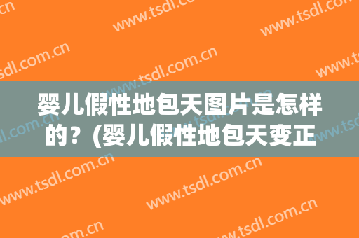婴儿假性地包天图片是怎样的？(婴儿假性地包天变正常的经验)