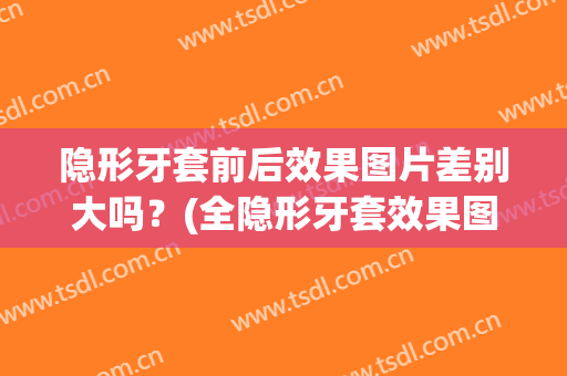 隐形牙套前后效果图片差别大吗？(全隐形牙套效果图)