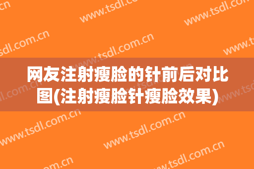 网友注射瘦脸的针前后对比图(注射瘦脸针瘦脸效果)