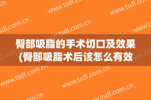 臀部吸脂的手术切口及效果(臀部吸脂术后该怎么有效护理)