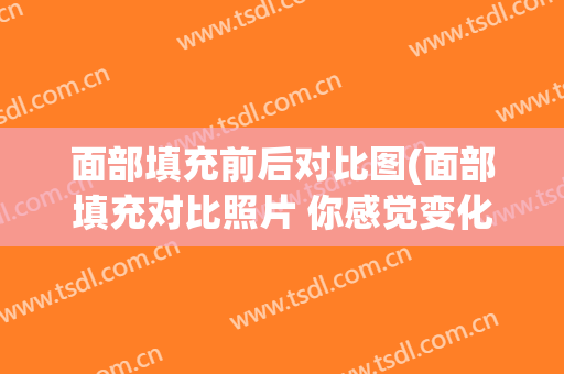 面部填充前后对比图(面部填充对比照片 你感觉变化大吗)