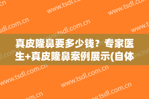 真皮隆鼻要多少钱？专家医生+真皮隆鼻案例展示(自体真皮隆鼻费用)