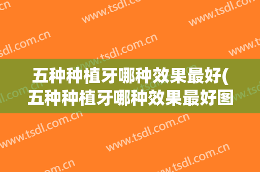 五种种植牙哪种效果最好(五种种植牙哪种效果最好图片)