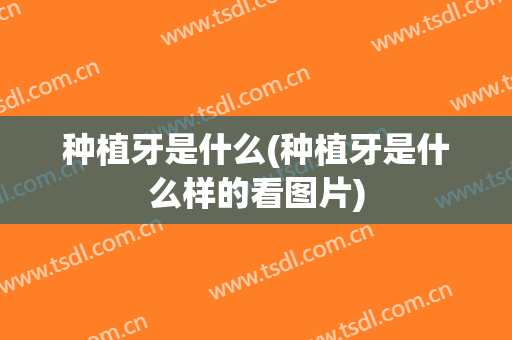 种植牙是什么(种植牙是什么样的看图片)