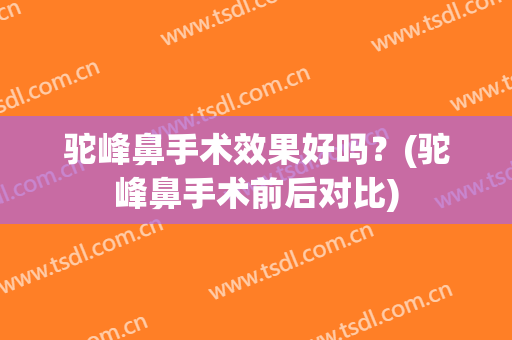 驼峰鼻手术效果好吗？(驼峰鼻手术前后对比)
