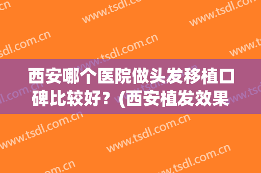 西安哪个医院做头发移植口碑比较好？(西安植发效果比较好的医院)