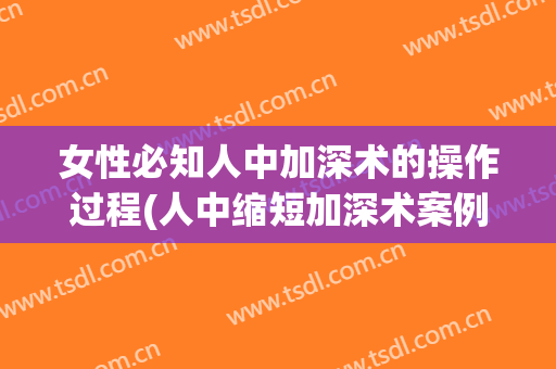 女性必知人中加深术的操作过程(人中缩短加深术案例)