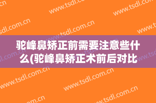 驼峰鼻矫正前需要注意些什么(驼峰鼻矫正术前后对比)