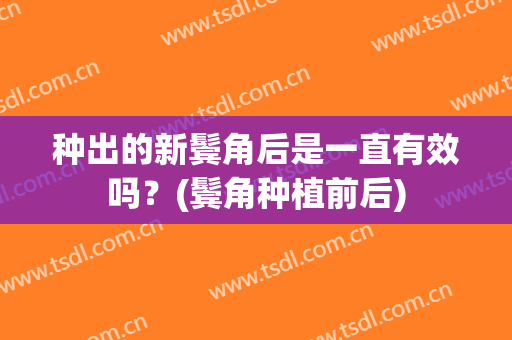 种出的新鬓角后是一直有效吗？(鬓角种植前后)