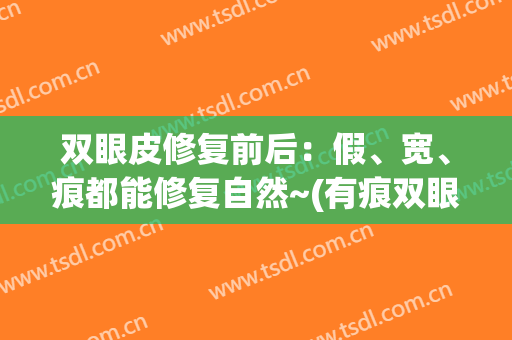 双眼皮修复前后：假、宽、痕都能修复自然~(有痕双眼皮可以修复无痕吗)