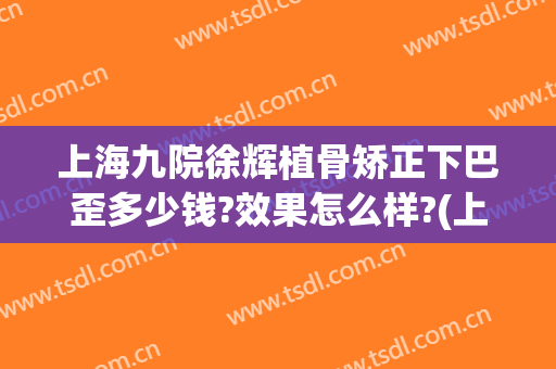 上海九院徐辉植骨矫正下巴歪多少钱?效果怎么样?(上海九院整形下巴多少钱)