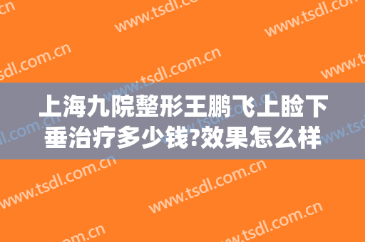 上海九院整形王鹏飞上睑下垂治疗多少钱?效果怎么样?(上海九院上睑下垂)