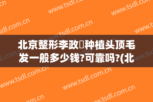 北京整形李政垚种植头顶毛发一般多少钱?可靠吗?(北京种植毛发手术)