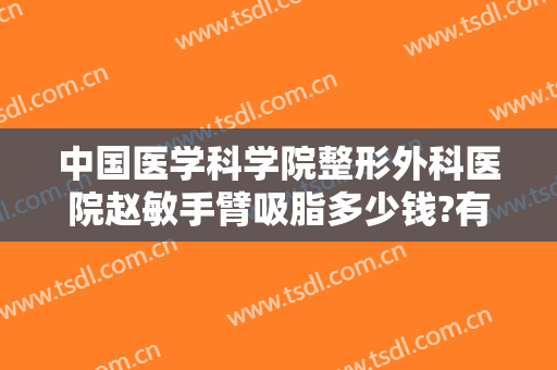 中国医学科学院整形外科医院赵敏手臂吸脂多少钱?有哪些优势?