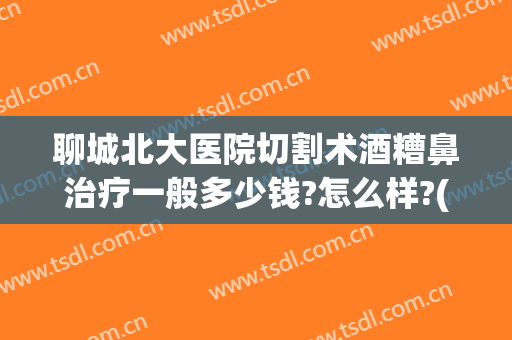 聊城北大医院切割术酒糟鼻治疗一般多少钱?怎么样?(酒糟鼻整形手术)