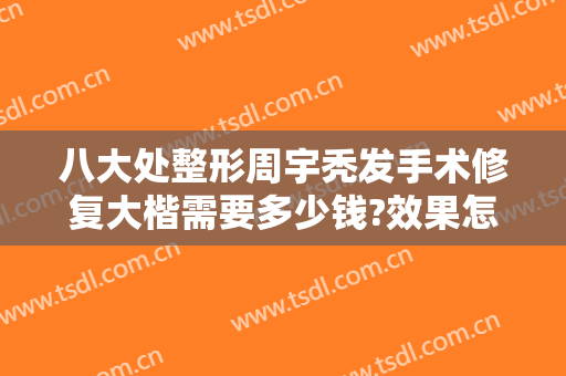 八大处整形周宇秃发手术修复大楷需要多少钱?效果怎么样?