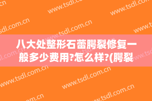 八大处整形石蕾腭裂修复一般多少费用?怎么样?(腭裂修复医院)
