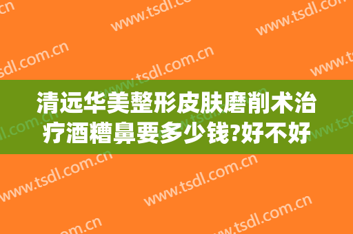 清远华美整形皮肤磨削术治疗酒糟鼻要多少钱?好不好?(激光去除酒糟鼻多少钱)