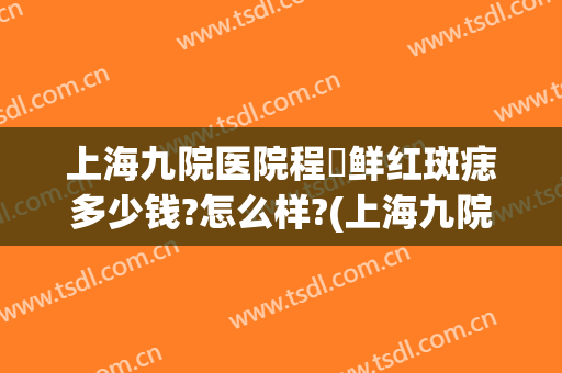 上海九院医院程昉鲜红斑痣多少钱?怎么样?(上海九院鲜红斑痣医生)