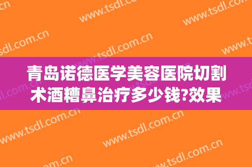 青岛诺德医学美容医院切割术酒糟鼻治疗多少钱?效果怎么样?(酒糟鼻切割术价格)