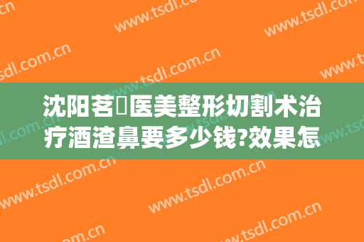 沈阳茗湲医美整形切割术治疗酒渣鼻要多少钱?效果怎么样?(沈阳茗湲整形医院)