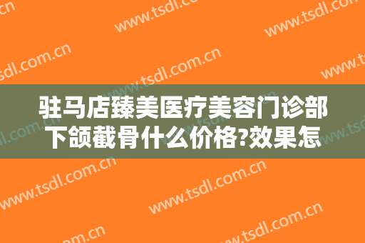 驻马店臻美医疗美容门诊部下颌截骨什么价格?效果怎么样?