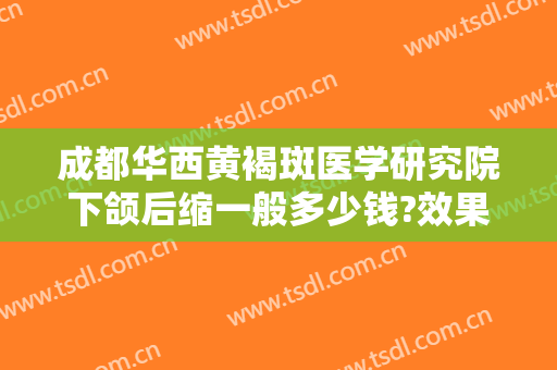 成都华西黄褐斑医学研究院下颌后缩一般多少钱?效果怎么样?