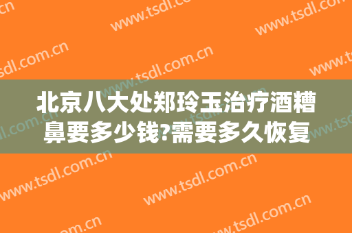 北京八大处郑玲玉治疗酒糟鼻要多少钱?需要多久恢复?(北京治疗酒糟鼻最好的医院)
