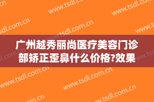 广州越秀丽尚医疗美容门诊部矫正歪鼻什么价格?效果怎么样?(广州尚美整形医院)