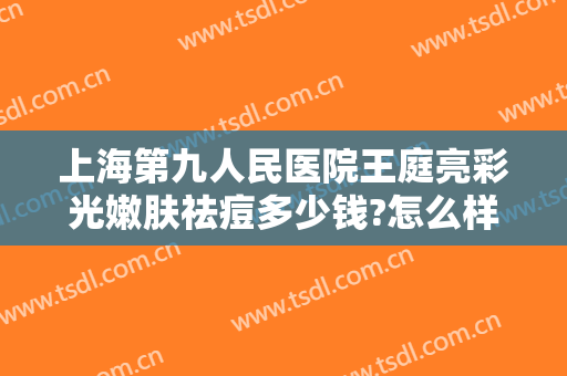 上海第九人民医院王庭亮彩光嫩肤祛痘多少钱?怎么样?