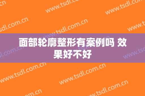 面部轮廓整形有案例吗 效果好不好