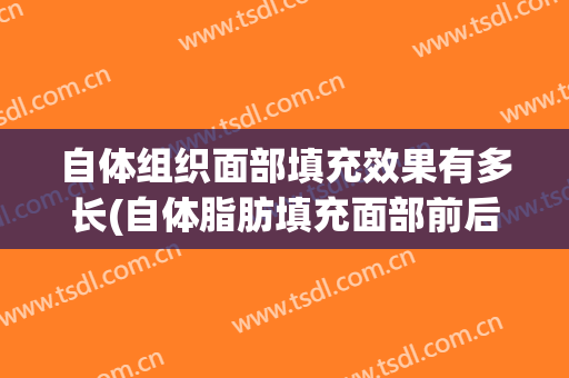自体组织面部填充效果有多长(自体脂肪填充面部前后)