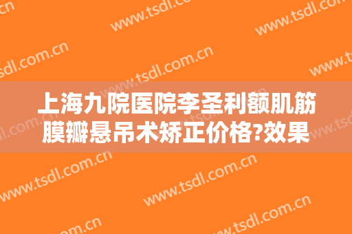 上海九院医院李圣利额肌筋膜瓣悬吊术矫正价格?效果怎么样?