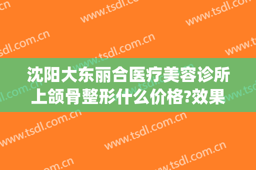 沈阳大东丽合医疗美容诊所上颌骨整形什么价格?效果怎么样?(沈阳丽合医疗美容医院)