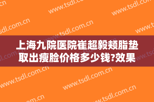 上海九院医院崔超毅颊脂垫取出瘦脸价格多少钱?效果怎么样?
