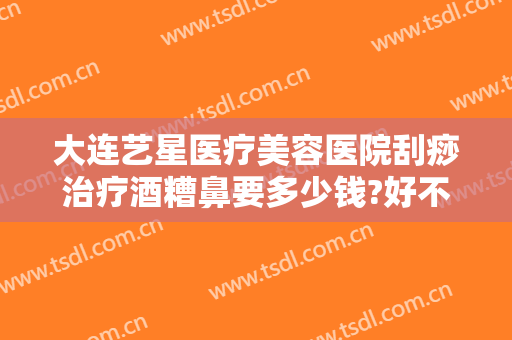 大连艺星医疗美容医院刮痧治疗酒糟鼻要多少钱?好不好?