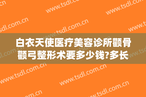 白衣天使医疗美容诊所颧骨颧弓整形术要多少钱?多长时间恢复?(颧骨整形大概要多少钱)