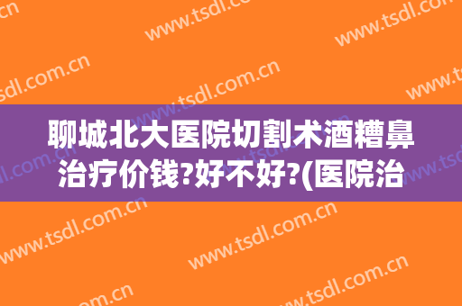 聊城北大医院切割术酒糟鼻治疗价钱?好不好?(医院治疗酒糟鼻多少钱)